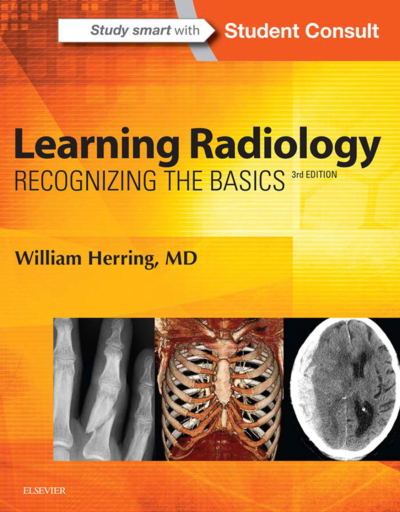 Learning Radiology: Recognizing The Basics / William Herring ANKA Fotokopi